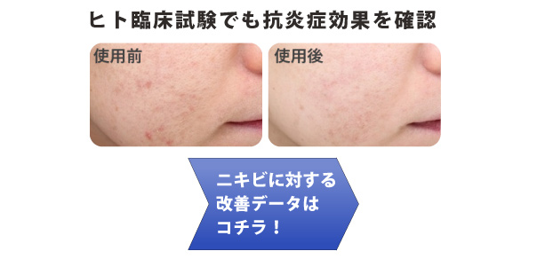 「1.LYZOXの特徴」へ