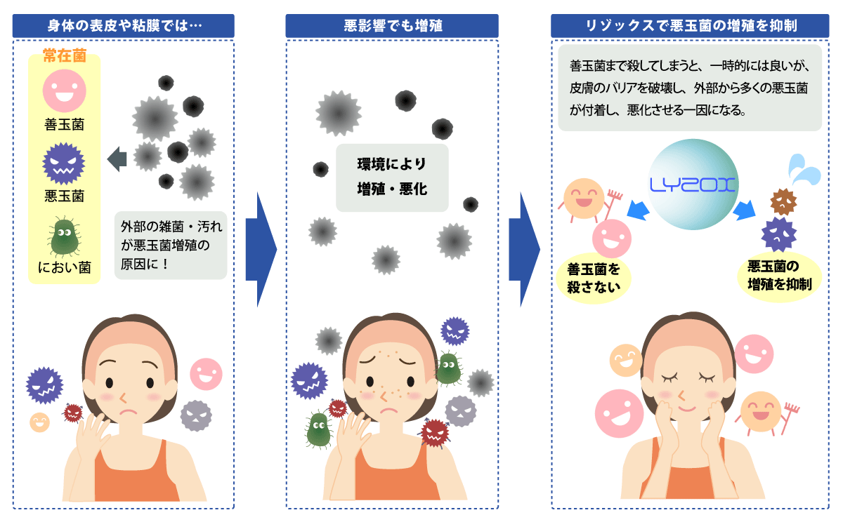 身体の表皮や粘膜では… 外部の雑菌・汚れが悪玉菌増殖の原因に! 悪影響でも増加 環境により増殖・悪化 リゾックスで悪玉菌の増殖を抑制 善玉菌まで殺してしまうと、一時的には良いが、皮膚のバリアを破壊し、外部から多くの悪玉菌が付着し、悪化させる一因になる。